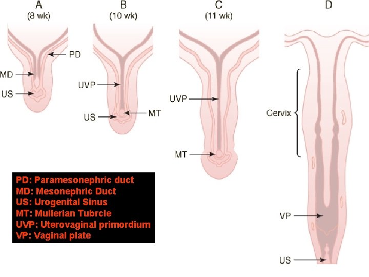 PD: Paramesonephric duct MD: Mesonephric Duct US: Urogenital Sinus MT: Mullerian Tubrcle UVP: Uterovaginal