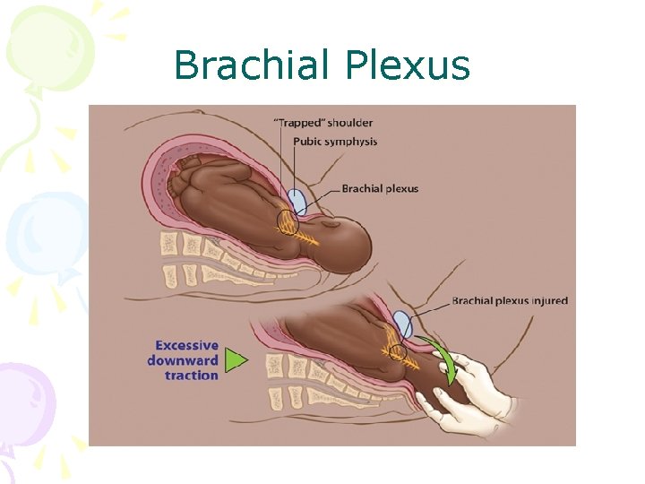 Brachial Plexus 