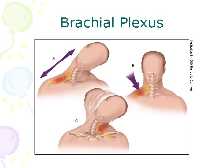 Brachial Plexus 