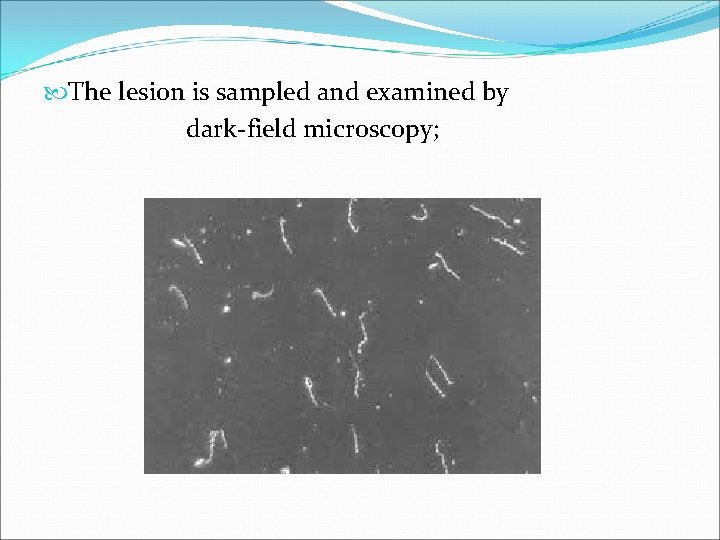  The lesion is sampled and examined by dark-field microscopy; 