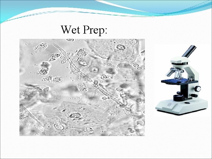 Wet Prep: 