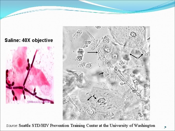 Saline: 40 X objective Source: Seattle STD/HIV Prevention Training Center at the University of