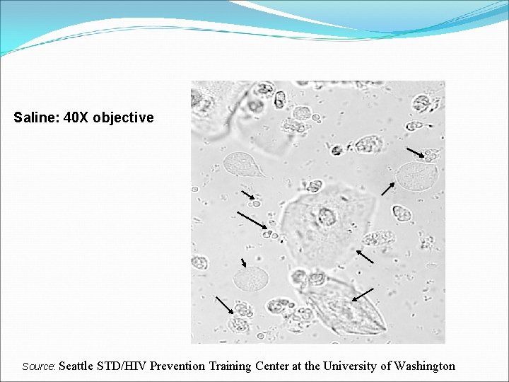 Saline: 40 X objective Source: Seattle STD/HIV Prevention Training Center at the University of