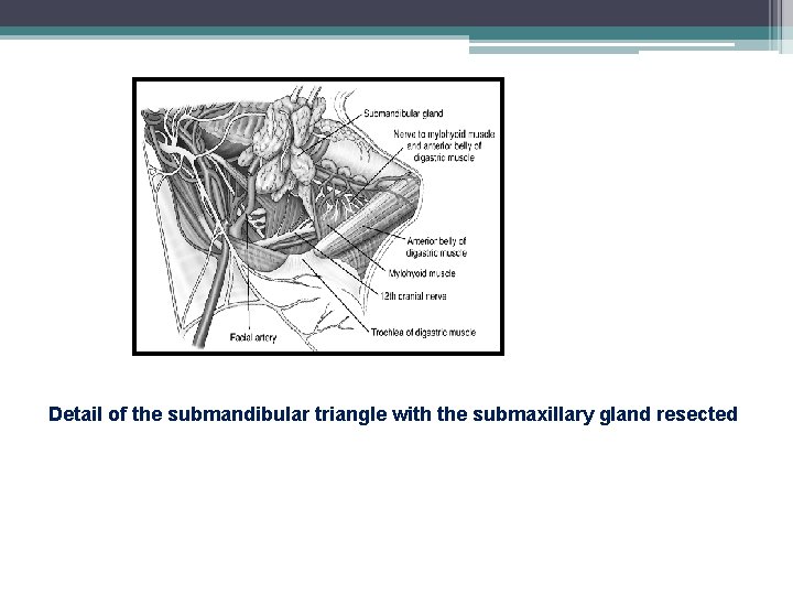 Detail of the submandibular triangle with the submaxillary gland resected 