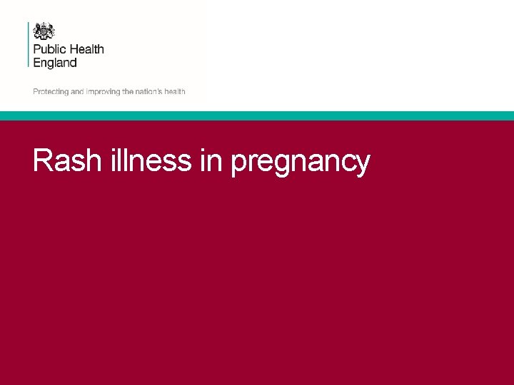 Rash illness in pregnancy 