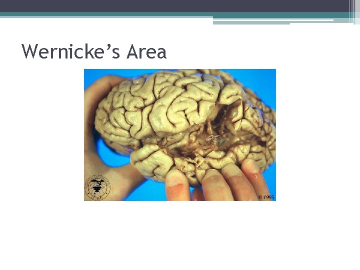 Wernicke’s Area 