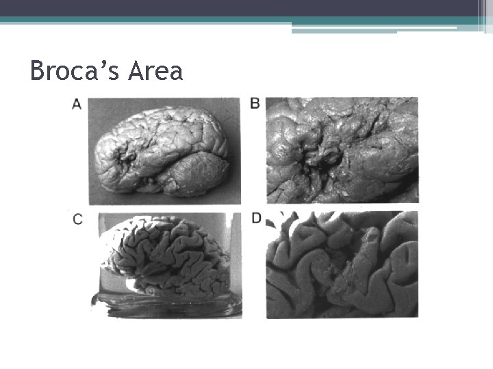 Broca’s Area 