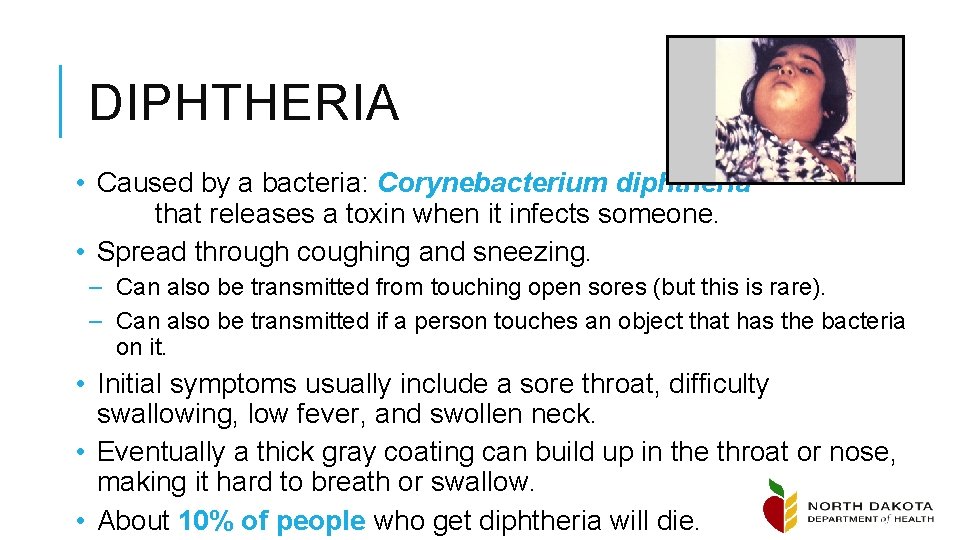 DIPHTHERIA • Caused by a bacteria: Corynebacterium diphtheria that releases a toxin when it