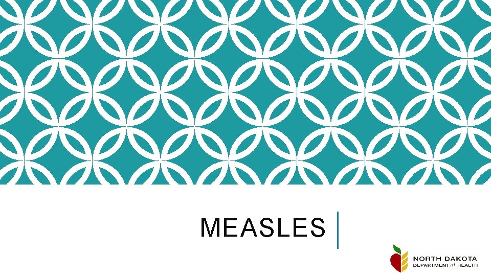 MEASLES 