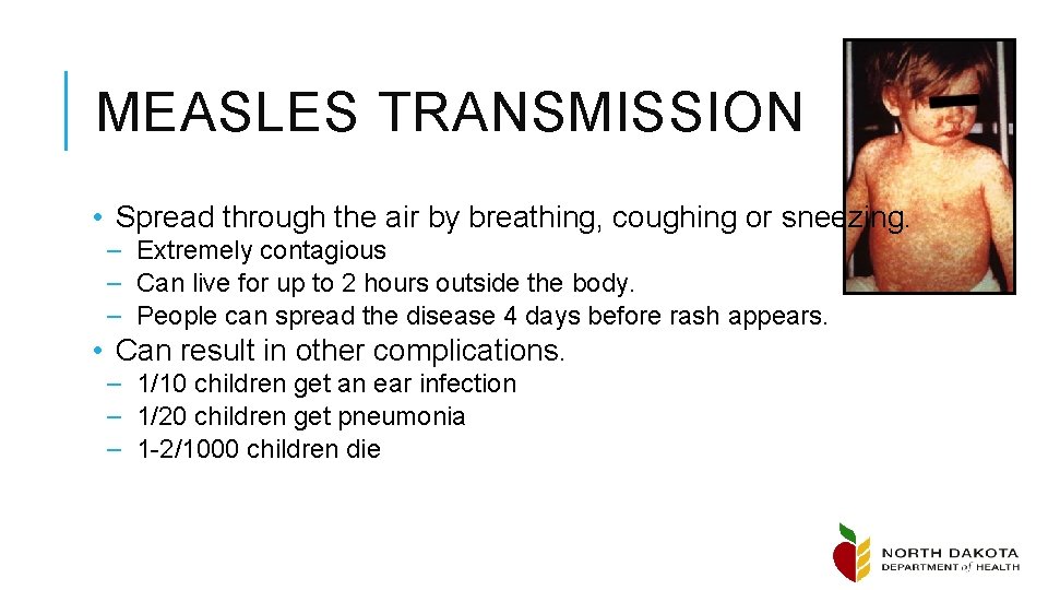 MEASLES TRANSMISSION • Spread through the air by breathing, coughing or sneezing. – Extremely