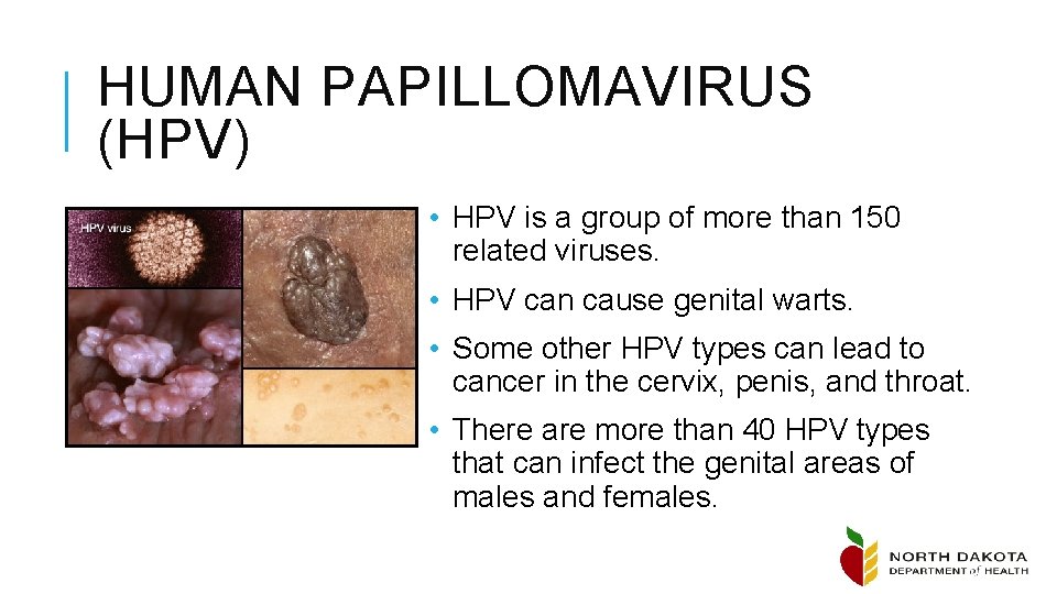HUMAN PAPILLOMAVIRUS (HPV) • HPV is a group of more than 150 related viruses.