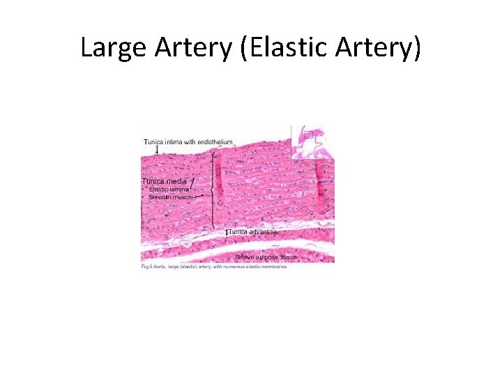 Large Artery (Elastic Artery) 