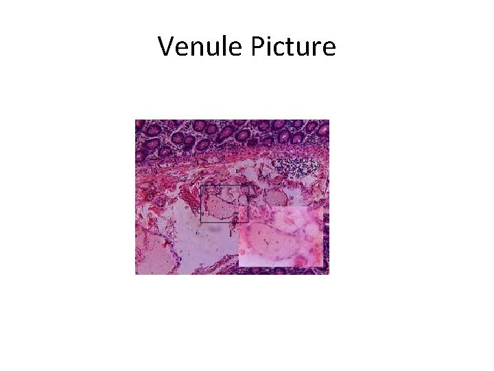 Venule Picture 