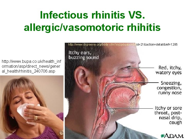 Infectious rhinitis VS. allergic/vasomotoric rhihitis http: //www. drgreene. org/body. cfm? xyzpdqabc=0&id=21&action=detail&ref=1285 http: //www. bupa.