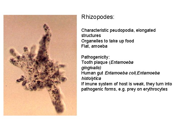 Rhizopodes: Characteristic peudopodia, elongated structures Organelles to take up food Flat, amoeba Pathogenicity: Tooth
