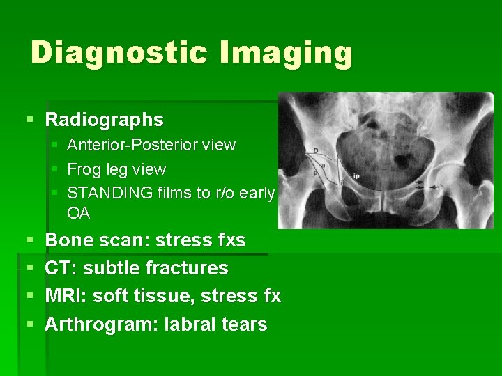 Diagnostic Imaging § Radiographs § Anterior-Posterior view § Frog leg view § STANDING films
