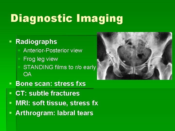 Diagnostic Imaging § Radiographs § Anterior-Posterior view § Frog leg view § STANDING films