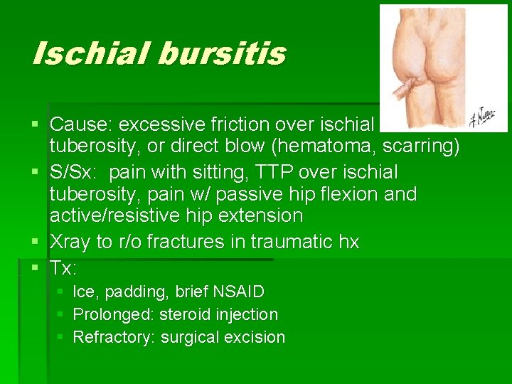 Ischial bursitis § Cause: excessive friction over ischial tuberosity, or direct blow (hematoma, scarring)