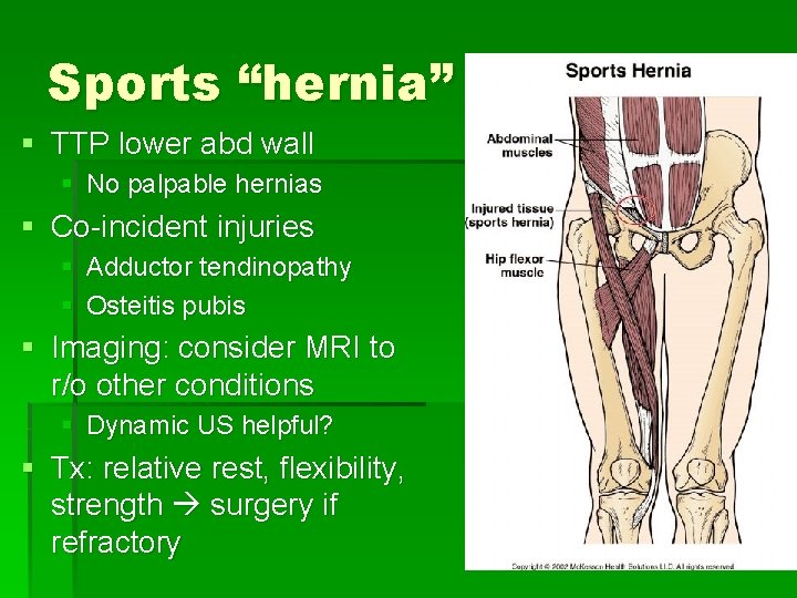 Sports “hernia” § TTP lower abd wall § No palpable hernias § Co-incident injuries