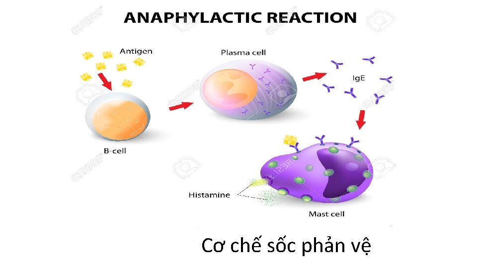 Cơ chế sốc phản vệ 