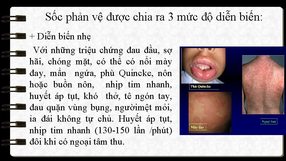 Sốc phản vệ được chia ra 3 mức độ diễn biến: + Diễn biến