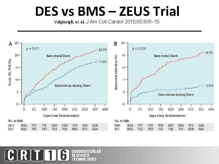 DES vs BMS – ZEUS Trial Valgimigli, et al. J Am Coll Cardiol 2015;