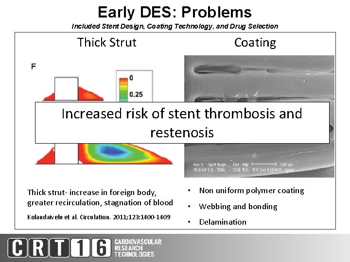 Early DES: Problems Included Stent Design, Coating Technology, and Drug Selection Thick Strut Coating