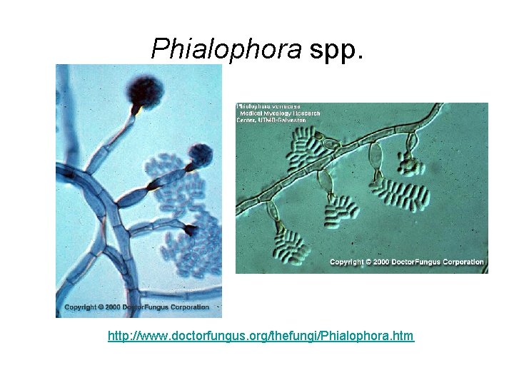 Phialophora spp. http: //www. doctorfungus. org/thefungi/Phialophora. htm 