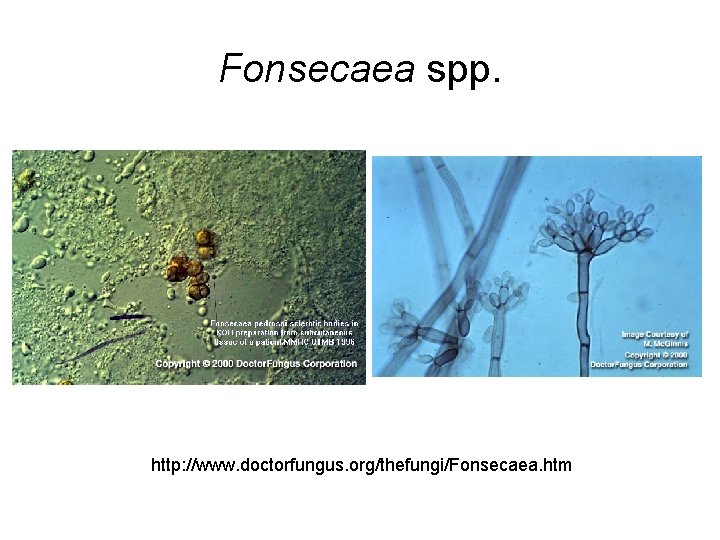 Fonsecaea spp. http: //www. doctorfungus. org/thefungi/Fonsecaea. htm 