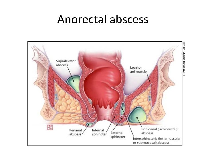 Anorectal abscess 