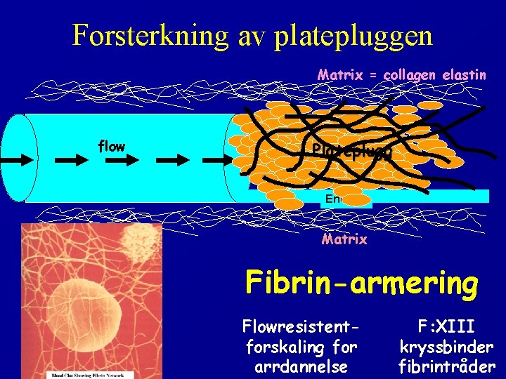 Forsterkning av platepluggen Matrix = collagen elastin flow Plateplugg Endotel Matrix Fibrin-armering Flowresistentforskaling for