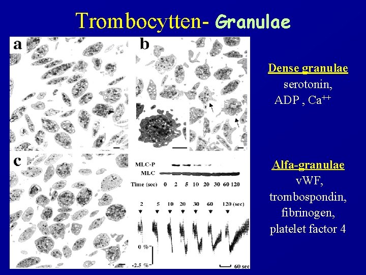 Trombocytten- Granulae Dense granulae serotonin, ADP , Ca++ Alfa-granulae v. WF, trombospondin, fibrinogen, platelet