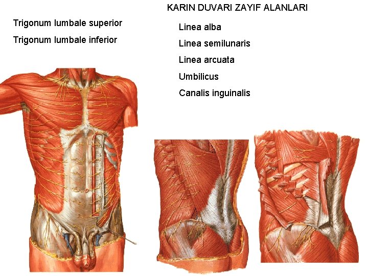 KARIN DUVARI ZAYIF ALANLARI Trigonum lumbale superior Linea alba Trigonum lumbale inferior Linea semilunaris