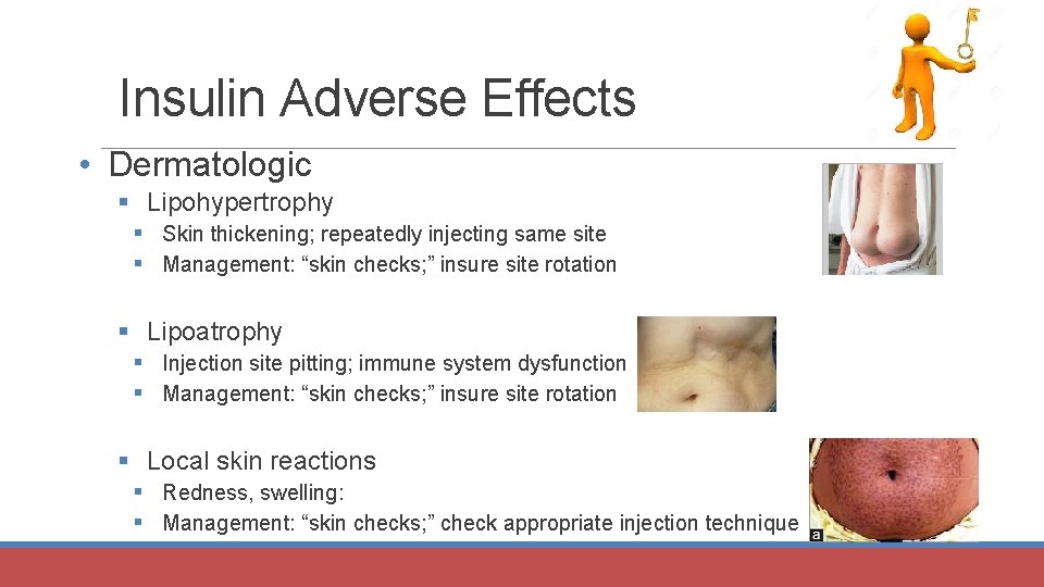 Insulin Adverse Effects • Dermatologic § Lipohypertrophy § Skin thickening; repeatedly injecting same site