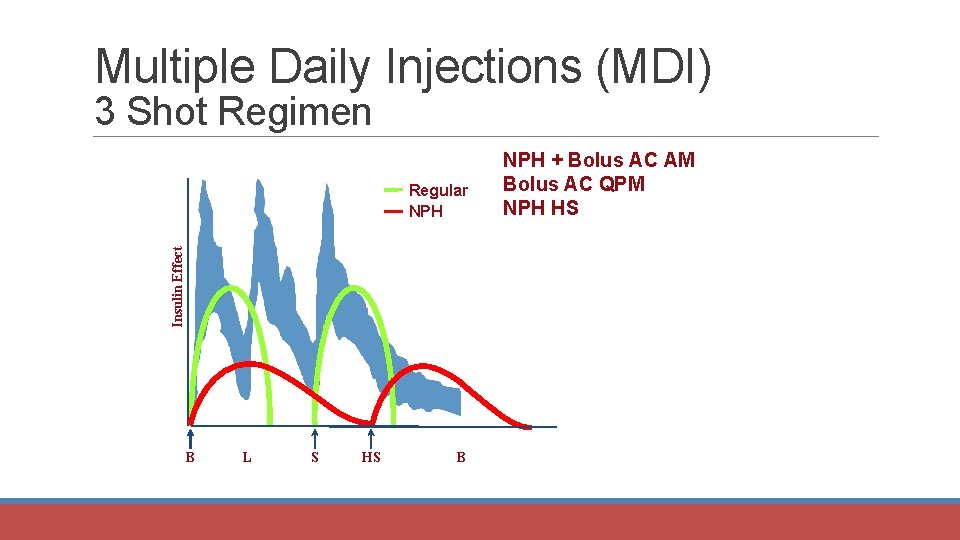Multiple Daily Injections (MDI) 3 Shot Regimen Insulin Effect Regular NPH B L S