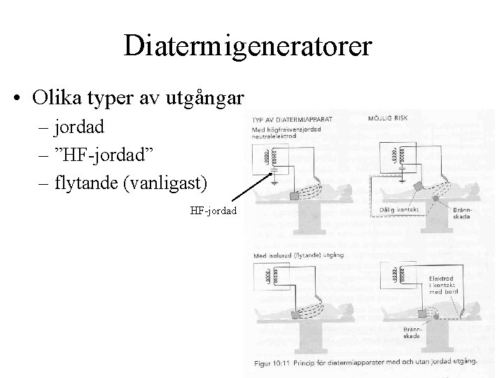 Diatermigeneratorer • Olika typer av utgångar – jordad – ”HF-jordad” – flytande (vanligast) HF-jordad