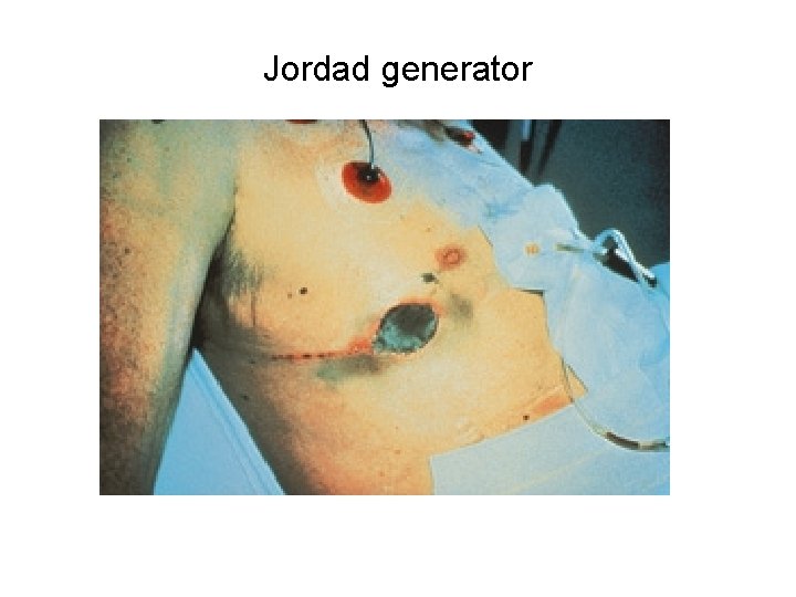 Jordad generator 