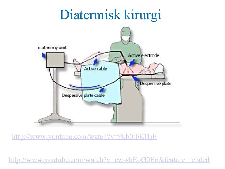 Diatermisk kirurgi http: //www. youtube. com/watch? v=9 kb 0 ib. Kl 1 j. E