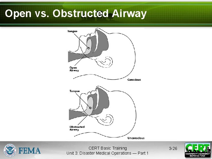 Open vs. Obstructed Airway CERT Basic Training Unit 3: Disaster Medical Operations — Part