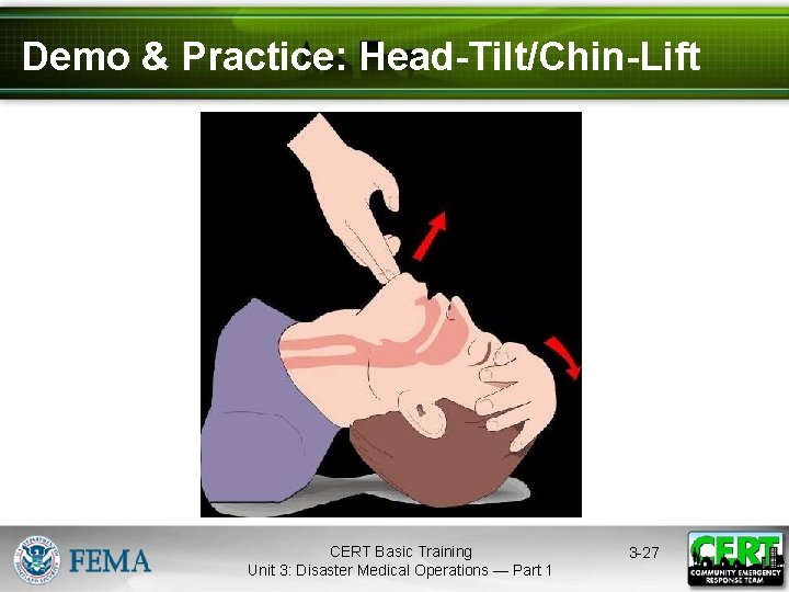 Demo & Practice: Head-Tilt/Chin-Lift CERT Basic Training Unit 3: Disaster Medical Operations — Part