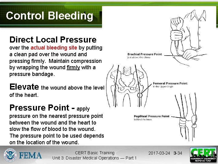 Control Bleeding Direct Local Pressure over the actual bleeding site by putting a clean