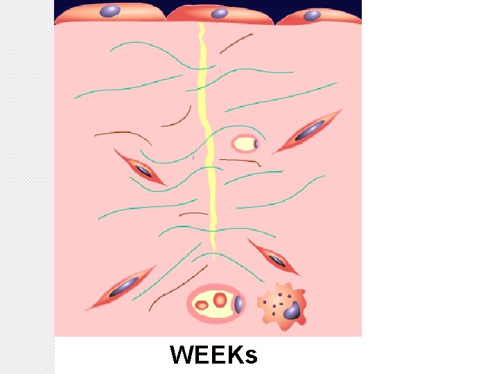 WEEKs 