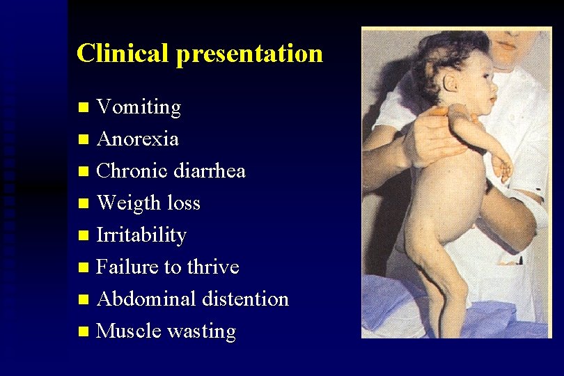 Clinical presentation Vomiting n Anorexia n Chronic diarrhea n Weigth loss n Irritability n