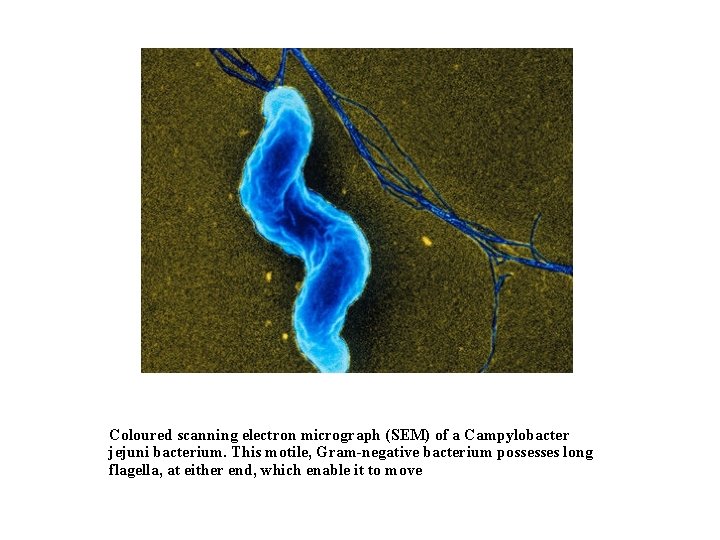 Coloured scanning electron micrograph (SEM) of a Campylobacter jejuni bacterium. This motile, Gram-negative bacterium