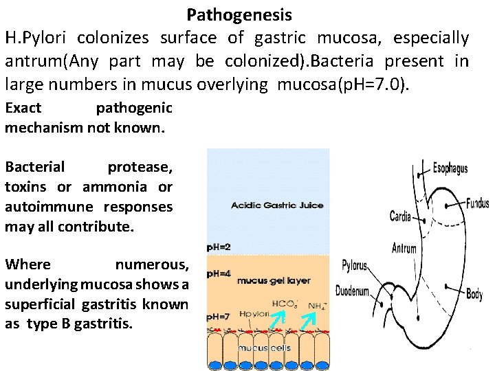 Pathogenesis H. Pylori colonizes surface of gastric mucosa, especially antrum(Any part may be colonized).
