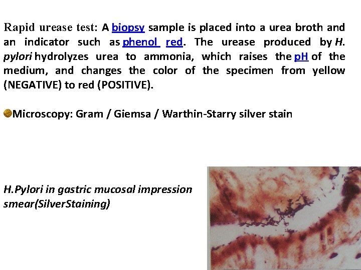 Rapid urease test: A biopsy sample is placed into a urea broth and an