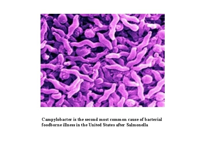 Campylobacter is the second most common cause of bacterial foodborne illness in the United