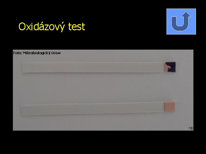 Oxidázový test Foto: Mikrobiologický ústav 