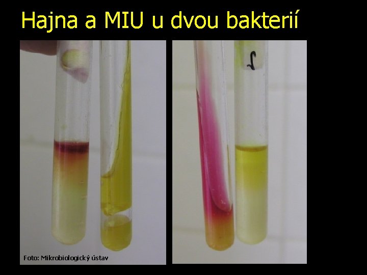 Hajna a MIU u dvou bakterií Foto: Mikrobiologický ústav 