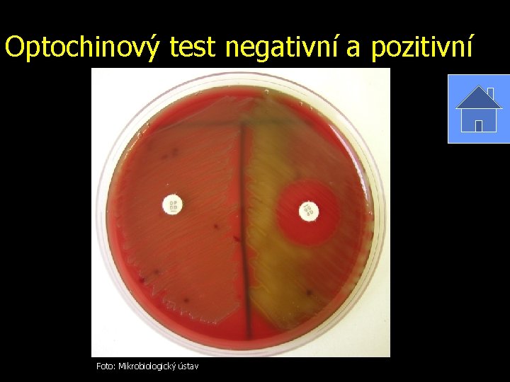 Optochinový test negativní a pozitivní Foto: Mikrobiologický ústav 